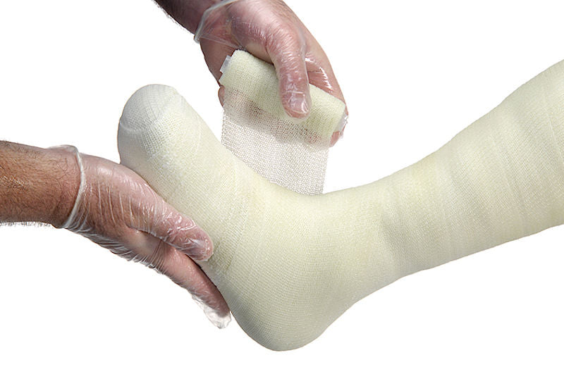 Cutimed Off-Loader Select Total Contact Cast System, Synthetic