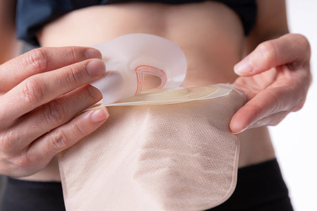 Ostomy Supplies